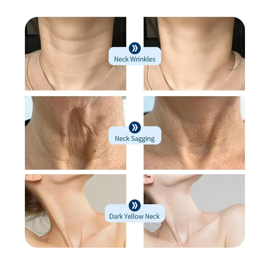Pura Forma LED Face Mask Pro — 7 Colori Terapia Luce Viso