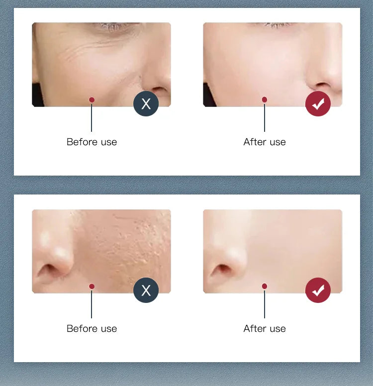 Pura Forma PDT Pro — Photon Light Therapy Professionale
