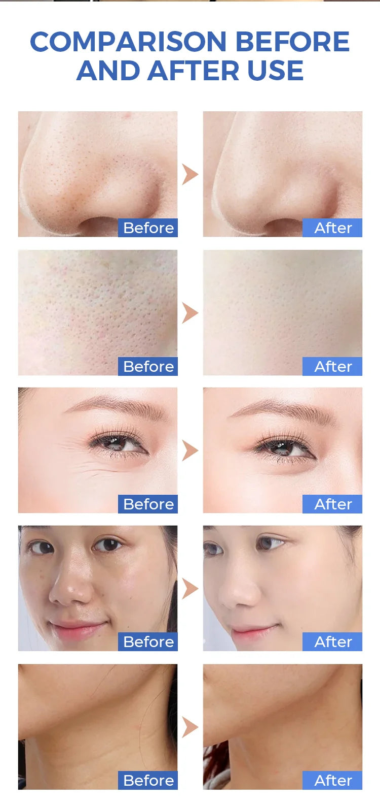 Pura Forma Pro Mask — Edizione Limitata